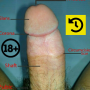 icon Penis Anatomy(Penis Anatomisi
)