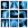 icon Medical X-Ray Interpretation(100+ Vaka ile Tıbbi Röntgen Yorumu
)