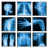 icon Medical X-Ray Interpretation(100+ Vaka ile Tıbbi Röntgen Yorumu
) 4.0.2