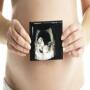 icon Ultrasound pregnancy guide(Ultrason gebelik rehberi)